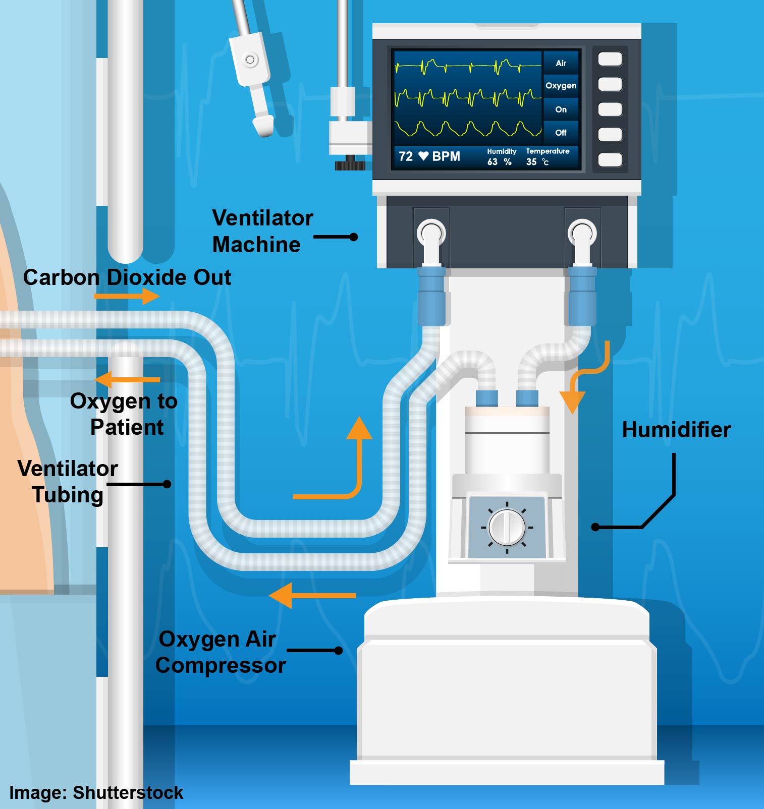 Components and Diagram of a Mechanical Ventilator